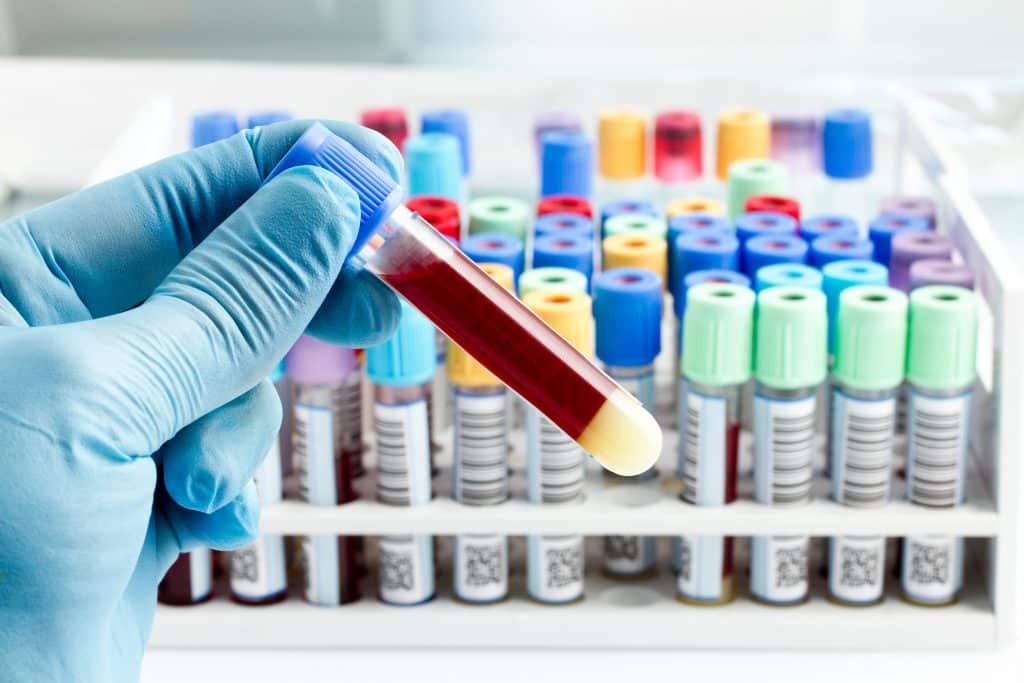 laboratory technician holding a blood tube test